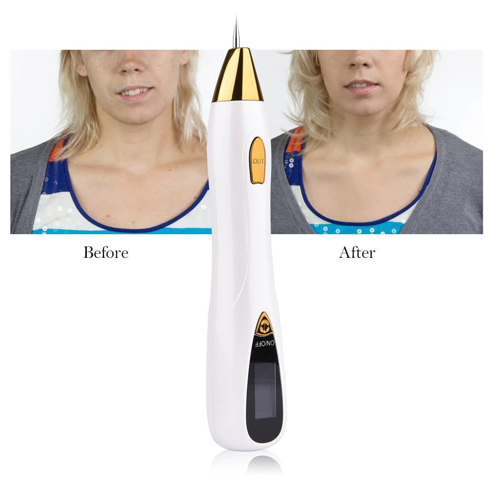 DermaClear Stylo pour l'Elimination des Grains de Beauté