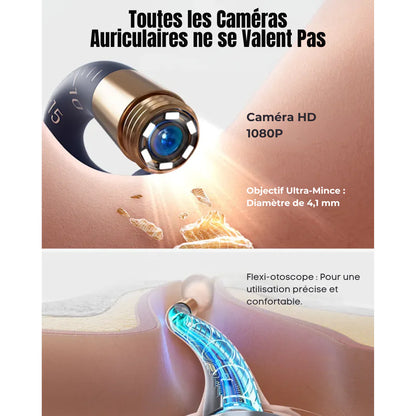 Pulitore per Orecchie Bebird EarSight Plus