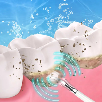 SparkSonic™ – Detartaratore Dentale Sonico con Irrigazione Integrata